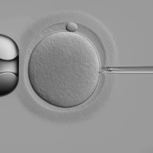 Curso práctico de ICSI: Denudación y Microinyección