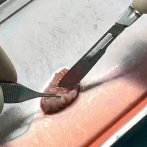 Advanced Course in Ovarian Tissue Cryopreservation